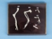 Front Limb Comparison Mount - 1072-51021 (Y2PRK)