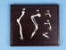 Front Limb Comparison Mount - 1072-51021 (Y2PRK)
