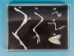 Hind Limb Comparison Mount - 1072-51022 (Y2PRK)