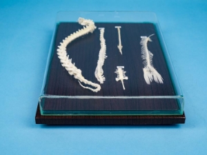 Spinal Column Comparison Mount 