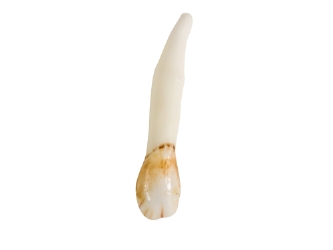 Moose Tooth: Whitened 